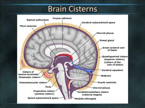 Ppt Brain Cisterns Powerpoint Presentation Id2263744