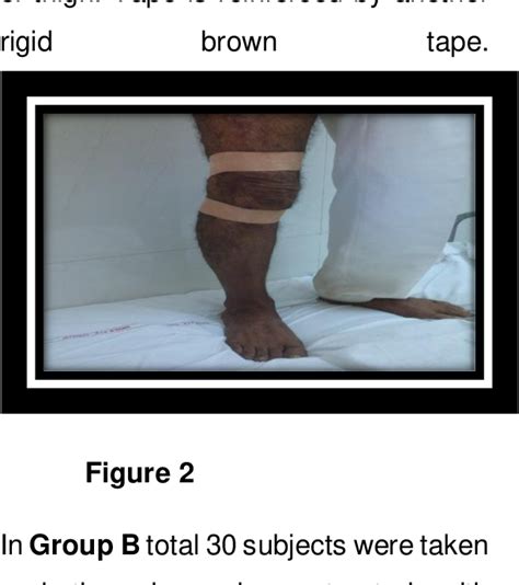 Figure From The Effect Of Mulligan Technique In Comparison With