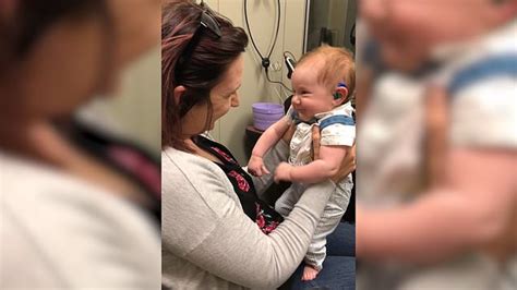 Watch Baby With Hearing Loss Hears Mums Voice For The First Time