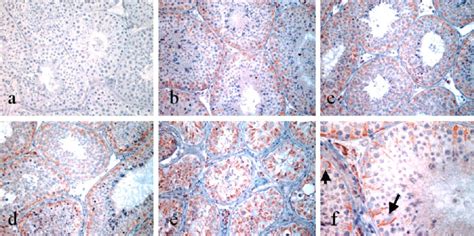 Immunohistochemical Staining Of Hsp60 In Testes Of Cynomolgus Macaca