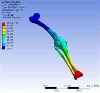 Injury Assessment Via Stress Analysis Of The Human Knee Joint Extrica