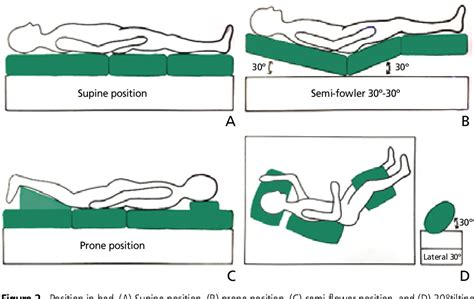 Figure 2 From Prevention And Treatment Of Pressure Ulcers Semantic Scholar