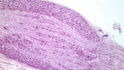 Dorsal Root Ganglion Histology