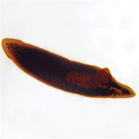 Planaria, w.m., Digestive Tract Completely Colored Microscope Slide ...