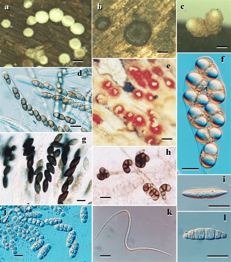 Common And New Records Of Marine Fungi Found At Hat Khanom Mu Ko Thale