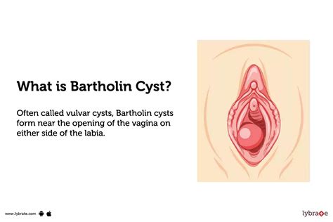 Bartholin Gland Duct