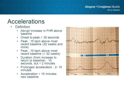 Fhr Acceleration