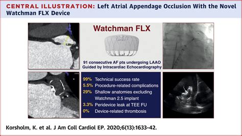 The Watchman Flx Device First European Experience And Feasibility Of