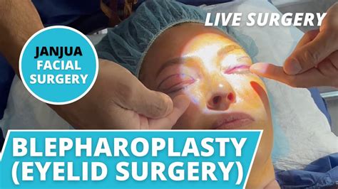 Journey Of A Blepharoplasty Live Surgery Dr Tanveer Janjua New