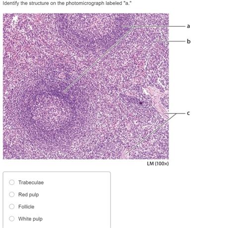 Solved Identify the structure on the photomicrograph labeled | Chegg.com