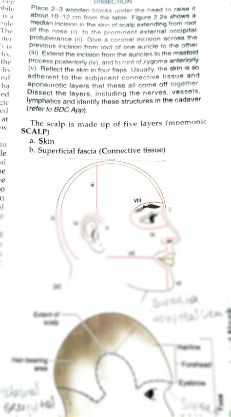 SOLUTION: Scalp layers - Studypool