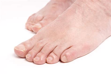 Sharp Pain In Big Toe Tip Renew Physical Therapy