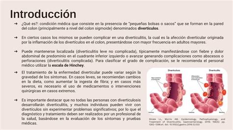 Enfermedad Diverticular De Colon By D Angelo Mon Ppt