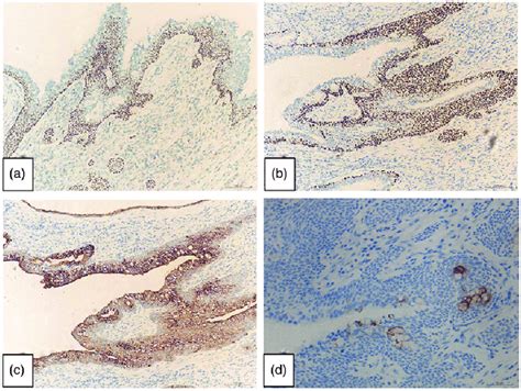 Representative Photomicrographs From Immunohistochemistry Of The