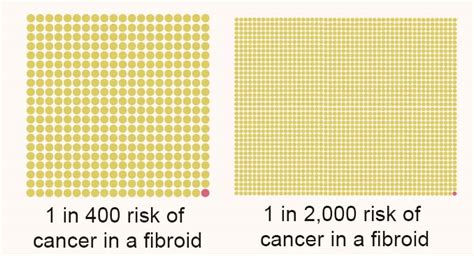 Uterine Fibroid Size Chart