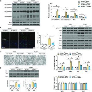 Rcan Deletion Reduced I R Initiated Mitochondrial Damage And