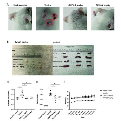 Treatment With Qnz Ameliorates Clinical Symptoms In Mrllpr Mice Download Scientific Diagram