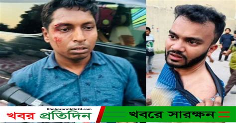 এফডিসিতে সাংবাদিকদের ওপর হামলা খবরপ্রতিদিন২৪কম