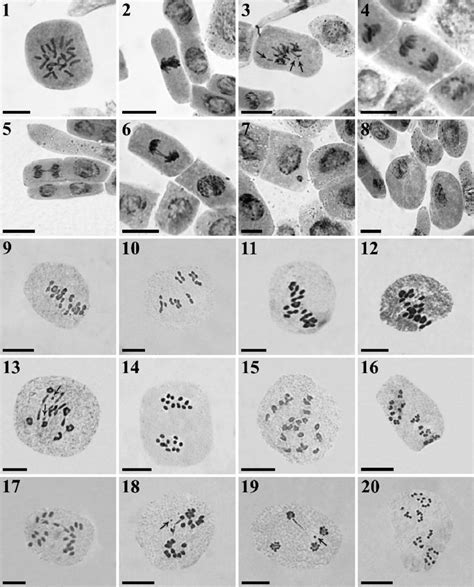 Metaphase Stage Of Mitosis Under Microscope Micropedia | Images and ...