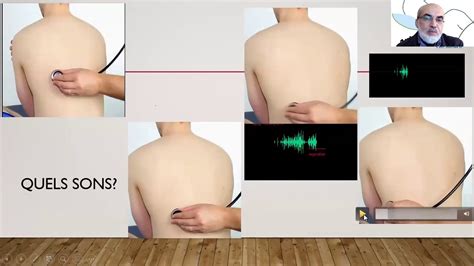 Part Stage Virtuel Examen Clinique En Pneumologie Pr Elbiaze Anormal