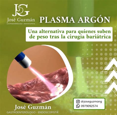 Plasma Argón José Guzman Gastroenterologo