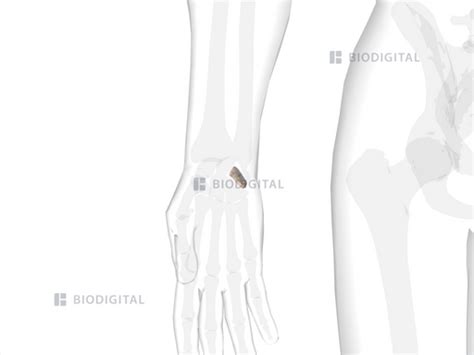 Right triquetrum | BioDigital Anatomy