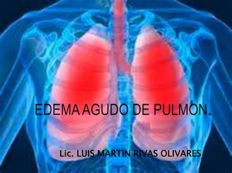 Edema Agudo De Pulmon Ppt