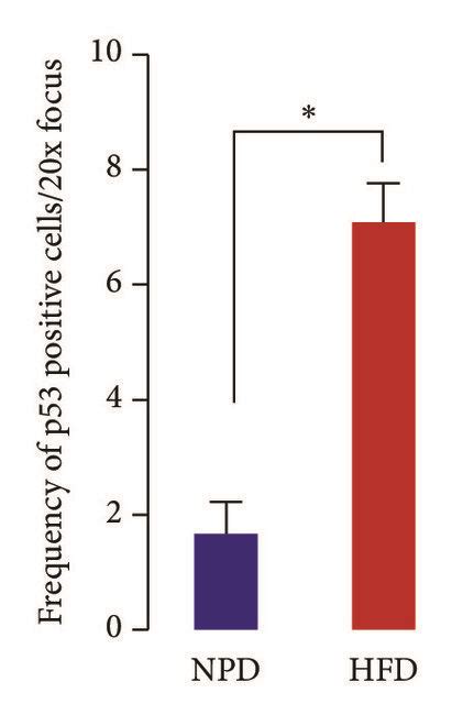 Chronic Hfd Feeding Accelerates Prostatic Aging And Cell Proliferation