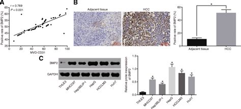 High Expression Of Bmp2 Is Found In Hcc And Positively Correlates With