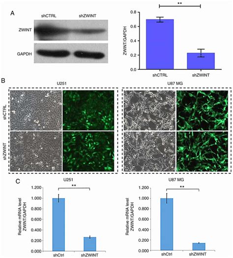 ZWINT Expression Is Effectively Knocked Down By ShRNA A Western Blot