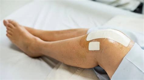 Knee Replacement Surgery Cost In Ludhiana Punjab