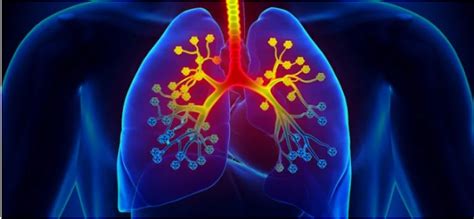 Asbestosis - Symptoms, Causes and Diagnosis