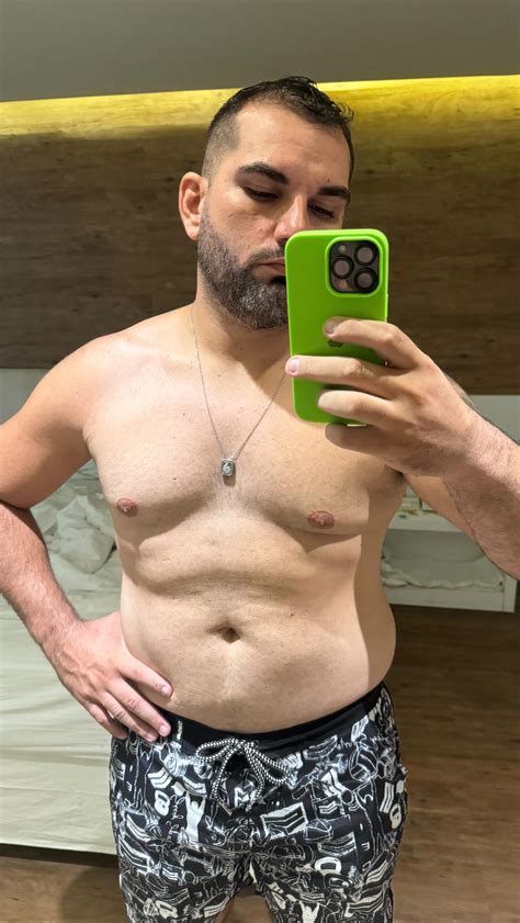 Rennê Mendes | Fazer a cirurgia bariátrica foi fácil, difícil é mudar