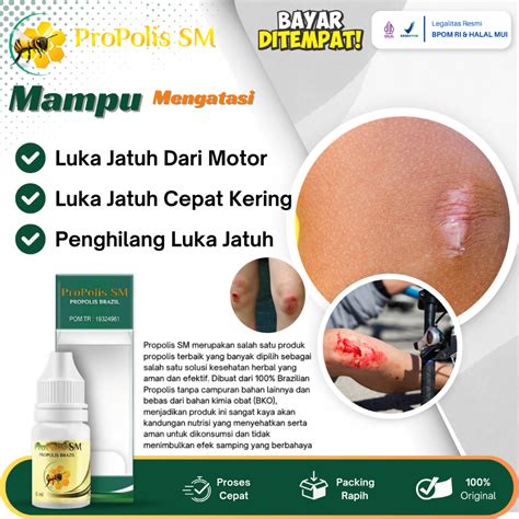 Jual Obat Luka Jatuh Dari Motor Luka Jatuh Cepat Kering Selep Bekas