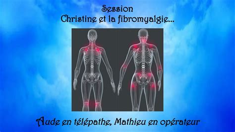 251 Session Hypnose Christine Et La Fibromyalgie YouTube