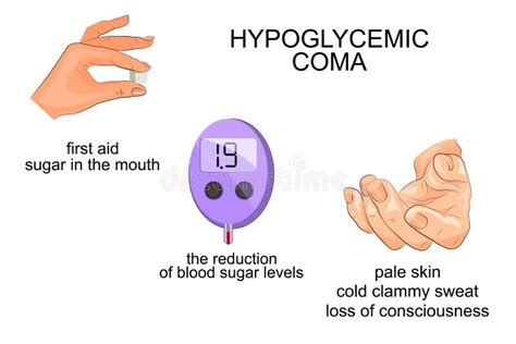 Symptoms And Help With Hypoglycemic Coma Stock Vector Illustration Of