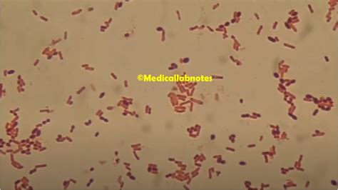 Yersinia Introduction Classification Morphology Pathogenicity Lab