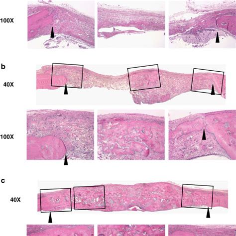 Histologic Analysis Of Bone Regeneration In Critical Size Defects Download Scientific Diagram