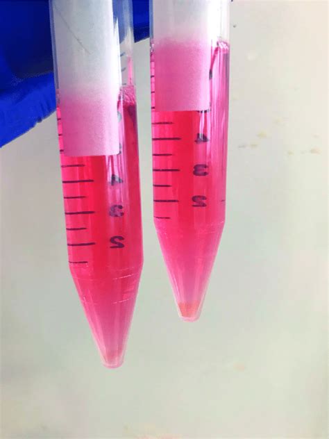 Cell pellet obtained from digestion of both compartments Example cell ...