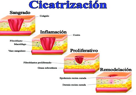 Fases en la cicatrización Download Scientific Diagram