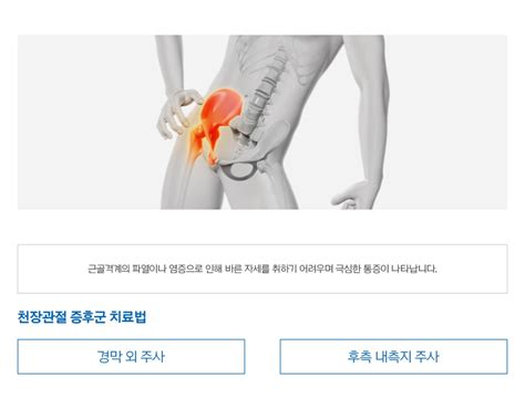 허리 통증 인천메트로정형외과