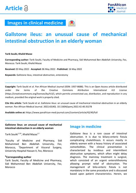 PDF Gallstone Ileus An Unusual Cause Of Mechanical Intestinal