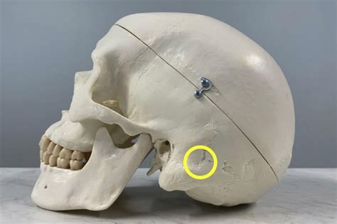 Trigeminal Neuralgia With Dr Mian Carepoint Neurosurgery And Spine