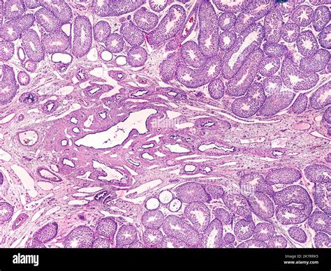 Light Microscope Micrograph Of A Human Testicle At Centre Is The Rete Testis Surrounded By