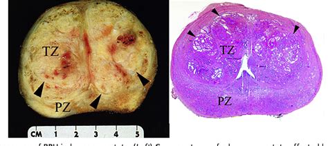 Figure 1 From Review Of Prostate Anatomy And Embryology And The