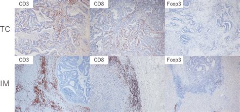 Representative Immunohistochemical Images Of Cd Cd And Foxp