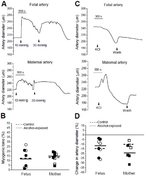 Myogenic Tone And Responses To High Kcl In Fetal And Maternal Arteries