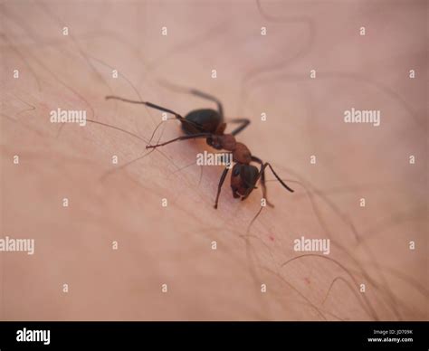 Ant Bites Skin Hi Res Stock Photography And Images Alamy