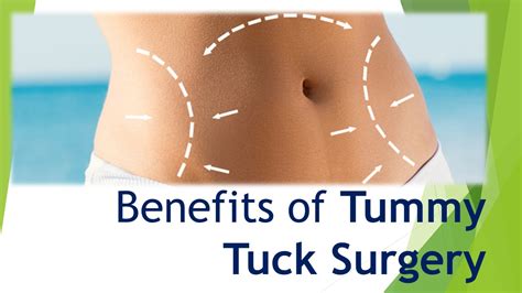 Ppt Benefits Of Tummy Tuck Surgery Powerpoint Presentation Free To