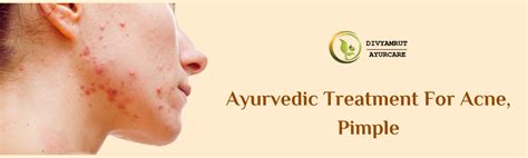 Ayurvedic Treatment For Acne Pimple Divyamrut Ayurcare